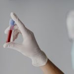 Gloved hand holding a small blood sample tube with red liquid and blue cap in a clinical setting