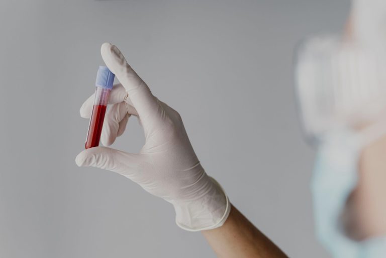 Gloved hand holding a small blood sample tube with red liquid and blue cap in a clinical setting