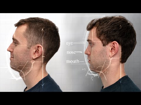 Before after mewing yang diklaim bisa mensimetriskan wajah
