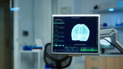 Menurut national institute of neurological disorders and stroke fnd adalah gangguan yang memengaruhi fungsi sistem saraf tanpa adanya kerusakan struktural yang jelas pada otak catrawarta Menurut national institute of neurological disorders and stroke fnd adalah gangguan yang memengaruhi fungsi sistem saraf tanpa adanya kerusakan struktural yang jelas pada otak