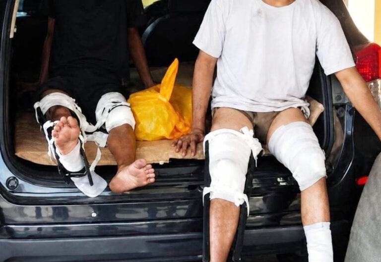 Two injured people sit in the open trunk of a car with leg casts and bandages on their legs, one barefoot toward the edge of the bumper.