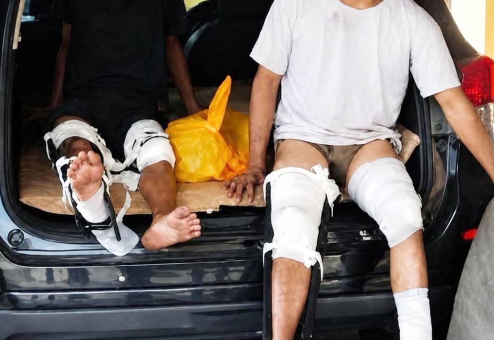 Two injured people sit in the open trunk of a car with leg casts and bandages on their legs one barefoot toward the edge of the bumper