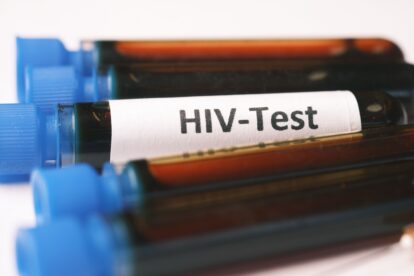 Ilustrasi hasil test HIV