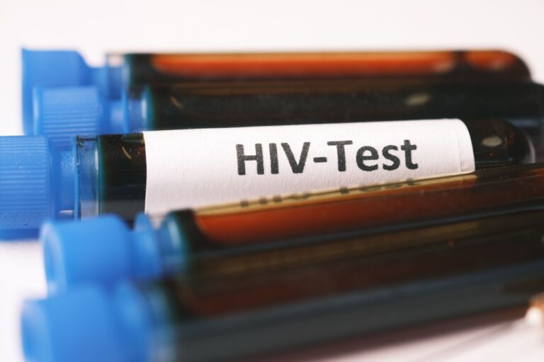 Ilustrasi hasil test HIV