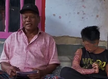 Two people sit side by side on a bench outside; an older man in a pink plaid shirt and black cap on the left, and a younger person with a large arm scar on the right.