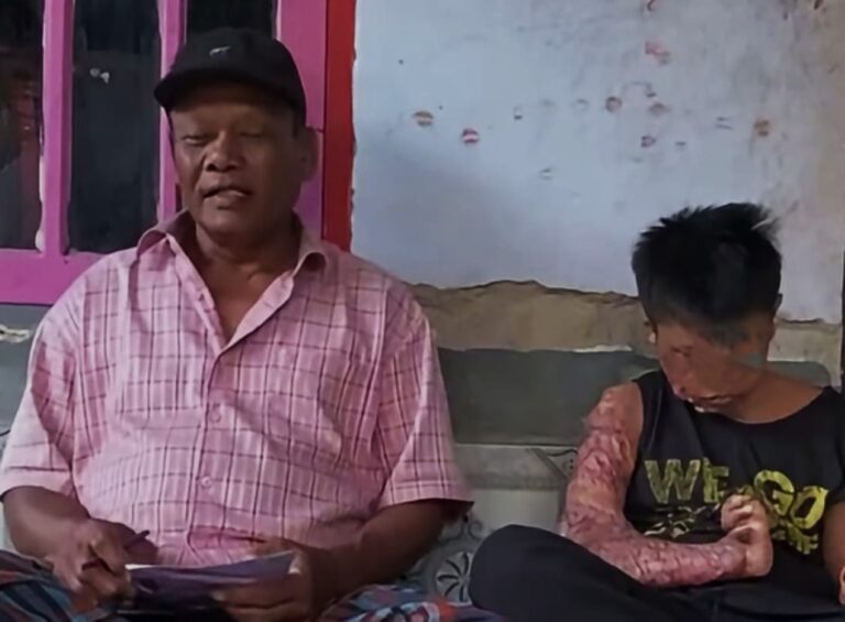 Two people sit side by side on a bench outside; an older man in a pink plaid shirt and black cap on the left, and a younger person with a large arm scar on the right.